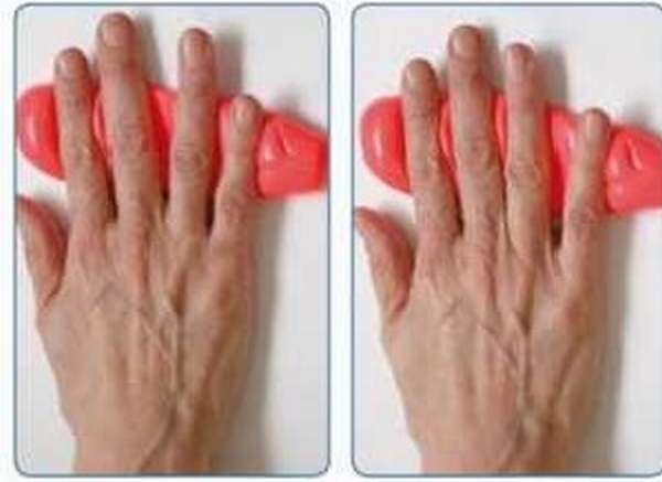 Остеоартроз кисти на руке